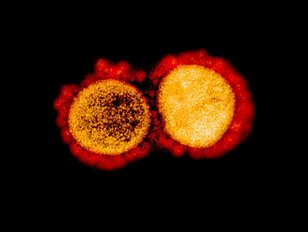 An image of the novel coronavirus, SARS-CoV-2, from the National Institute of Allergy and Infectious Disease. (NIAID photo)