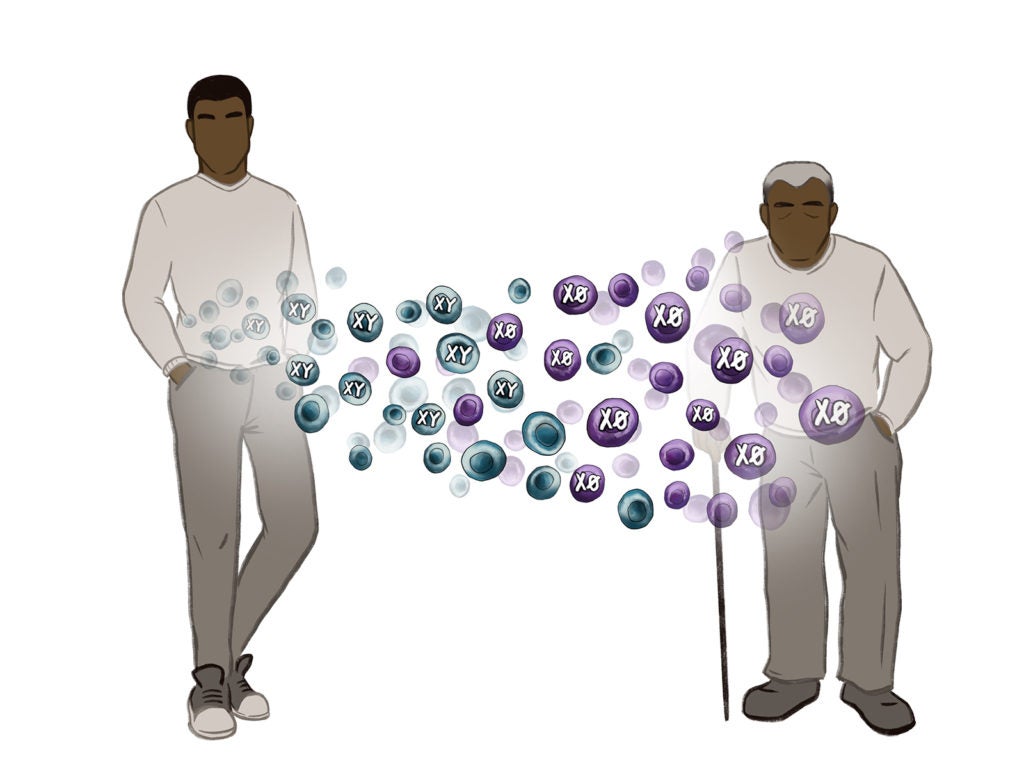 Approximately 40% of men will lose their male sex chromosome in certain cells by age 70, and that can lead to deadly heart failure, a new study finds.