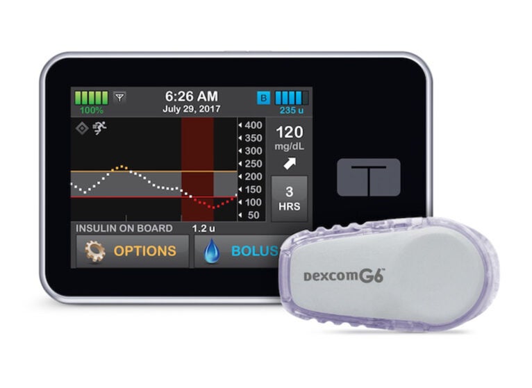 The Control-IQ artificial pancreas system was derived from research done at the Center for Diabetes Technology at the University of Virginia. Image credit: Tandem Diabetes Care