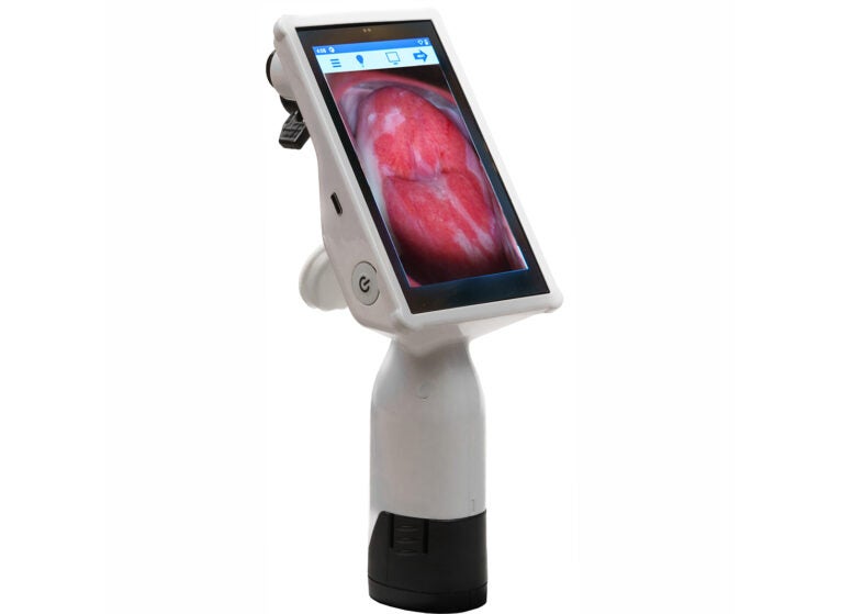 This small, highly portable piece of equipment helps detect and prevent Cervical Cancer in women across Appalachia thanks to a collaboration for women’s health involving The Health Wagon, Liger Medical and UVA Health.